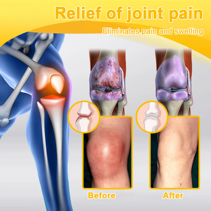 ADNOON™ Botulinum Toxin & Bee Venom Pain-Relief Bone Healing Cream